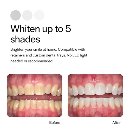 Opalescence 35% CP Mint - Gel Syringes Teeth Whitening - Refill Kit (2 Packs / 4 Syringes Total) Carbamide Peroxide Gel. Made by Ultradent. Tooth Whitening Refill Syringes 5197-2