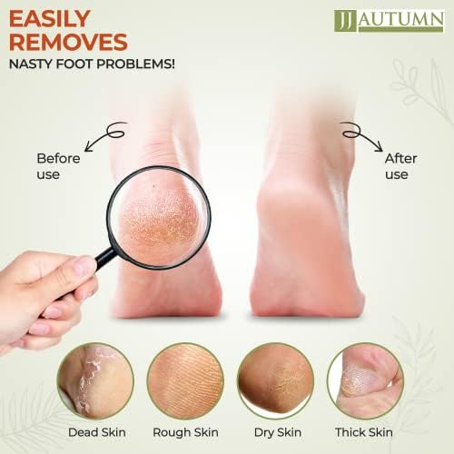 Spa Quality Foot Rasp/Callus Remover Double Sided Wood Professional Foot File Callus Remover for Pedicure and Foot Care - Can Be Used On Both Wet and Dry Feet Achieve Smooth, Silky Feet