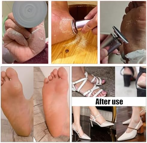 Electric Foot File Callus Remover Professional Foot File Pedicure Tools Adjustable Speed 120pcs Replacement Sandpaper disc Easy to Remove Cutin Dead Skin calluses for Men and Women(Rose Gold 120pcs)