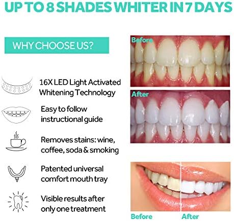 Teeth Whitening Accelerator Light, 16x More Powerful Blue LED Light, Mouth Tray Teeth Whitening Enhancer Light Trays Connected with iPhone/Micro-USB Android/USB for Home Use