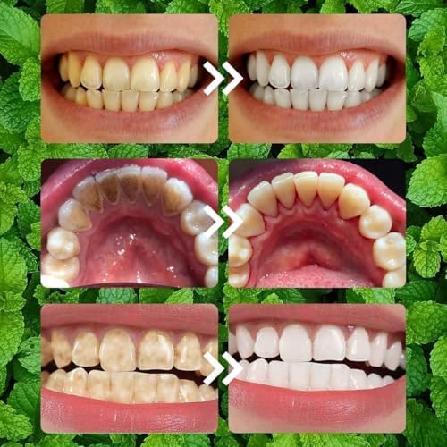 2PCS Purple Teeth Restoration Mineral Powder, Mineral Tooth Powder, Dental Restoration Mineral Effective in Strengthening Teeth and Gums for Daily Use