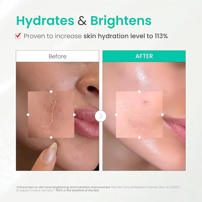 Dr.G Brightening Peeling Gel (120ml)