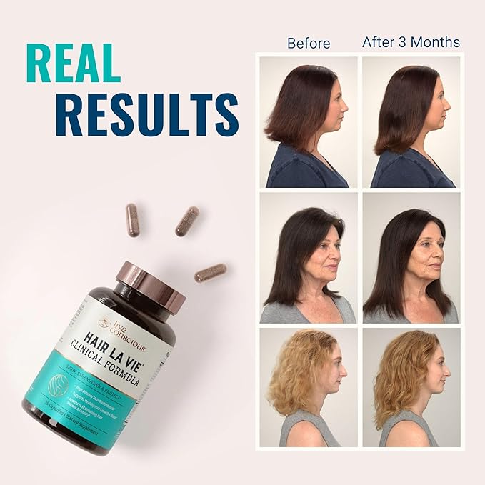 Hair La Vie Live Conscious Clinical Formula Hair Vitamins Capsule with Biotin and Saw Palmetto - Healthy Hair and Whole-Body Wellness (2-Pack)